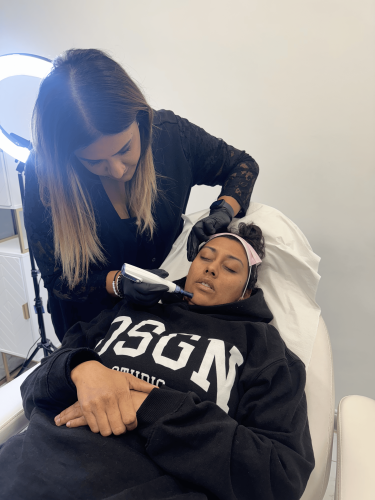 Microneedling